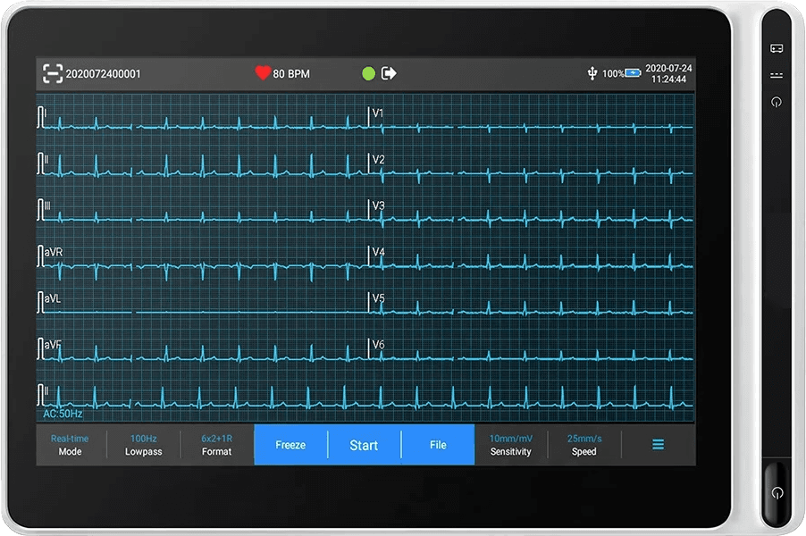 Illustration of aiTriage™ portable ECG device