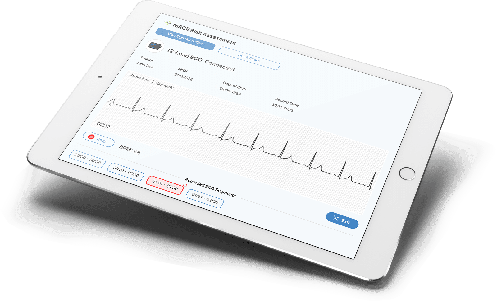 The aiTriage application on a tablet, recording a 12-lead ECG for a MACE risk assessment