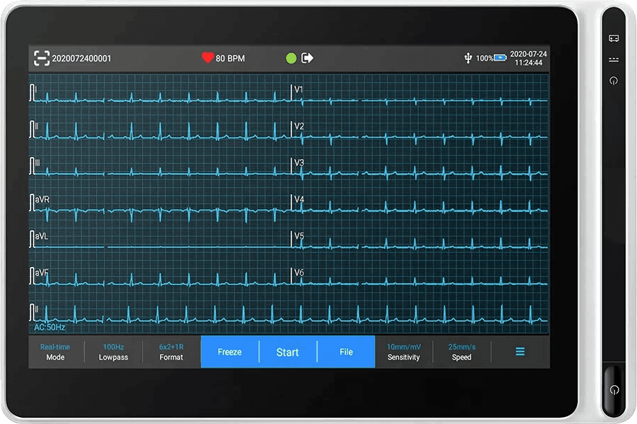 Portable 12-lead ECG equipment used with the aiTriage application
