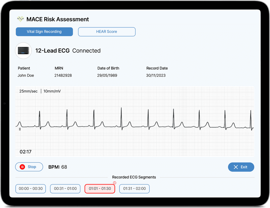 The aiTriage application on a tablet, recording a 12-lead ECG